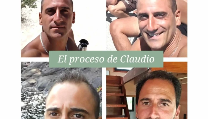Fertil Recuperacion Capilar Del Propietario - Punta del Este