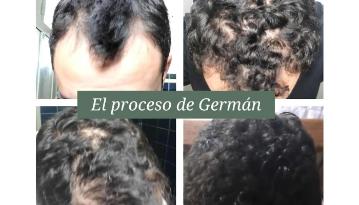Fertil Recuperacion Capilar Tienda De Cosmeticos - Punta del Este
